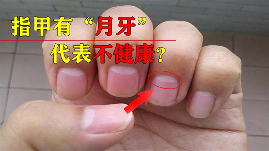 指甲的月牙代表什么