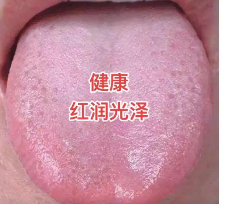 正常的舌头颜色的图片